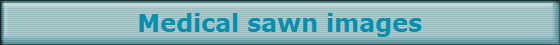 Medical sawn images